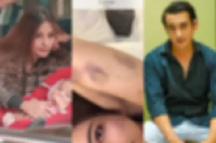 Baru 11 Bulan Nikah Sudah Babak Belur, Aliff Alli Tega Seret Hingga Gebuki Sang Istri: dari Pacaran Udah Main Gampar!