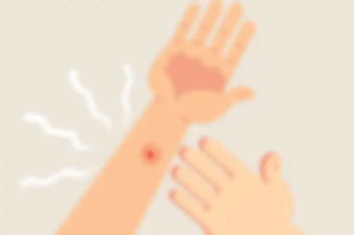 Ilustrasi bisul
