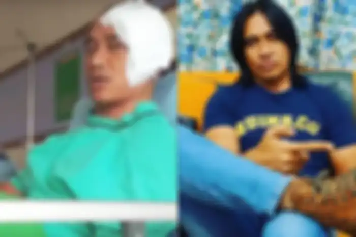 Meninggal di Usia Muda Karena Kanker Otak, Agung Hercules Ternyata Sempat Larang Sahabat Konsumsi 1 Makanan Ini Sebelum Meninggal