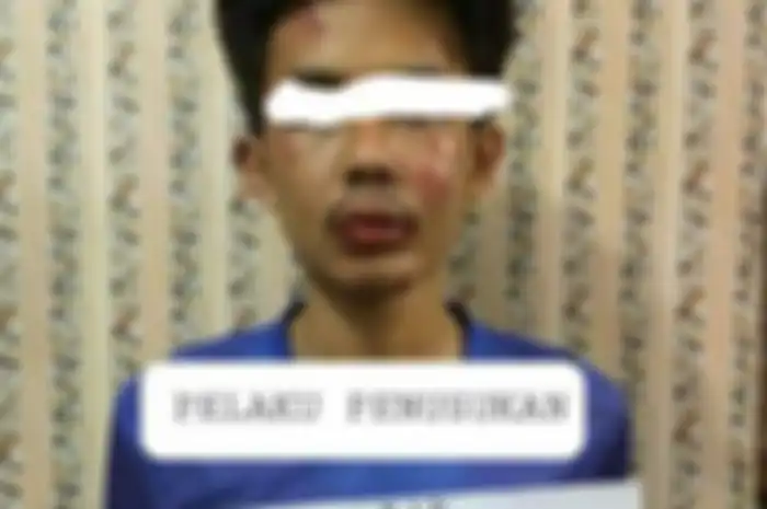 Sosok pelaku penusukan Syekh Ali Jaber