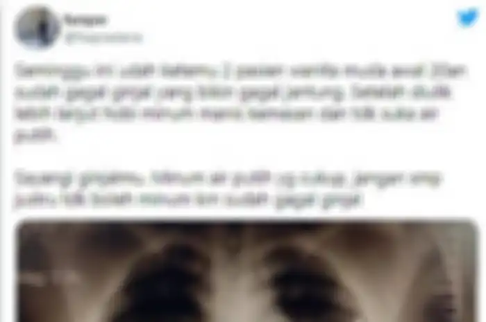 tangkapan layar dari twitter, yang memperlihatkan gambaran rontgen dari seorang pasien yang alami gagal ginjal karena disebabkan nggak doyan air putih