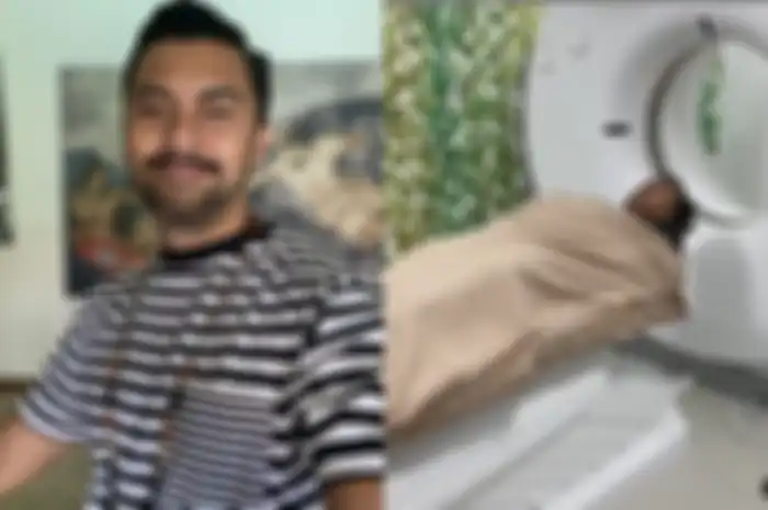 Anjasmara Tiba-tiba Lakukan Pemeriksaan MRI Pasca Alami Pembegalan Saat Bersepeda, Ada Apa?