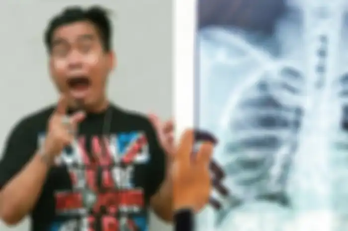 Bopak Castello harus sering konsumsi minuman ini akibat hanya miliki satu paru-paru