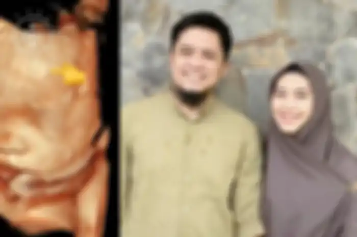 Lafaz Allah dalam foto USG anak Oki Setaiana Dewi