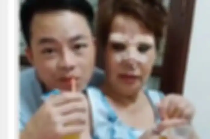 Nikahi brondong, nenek 62 tahun ini rela permak wajah lewat operasi plastik demi terlihat muda