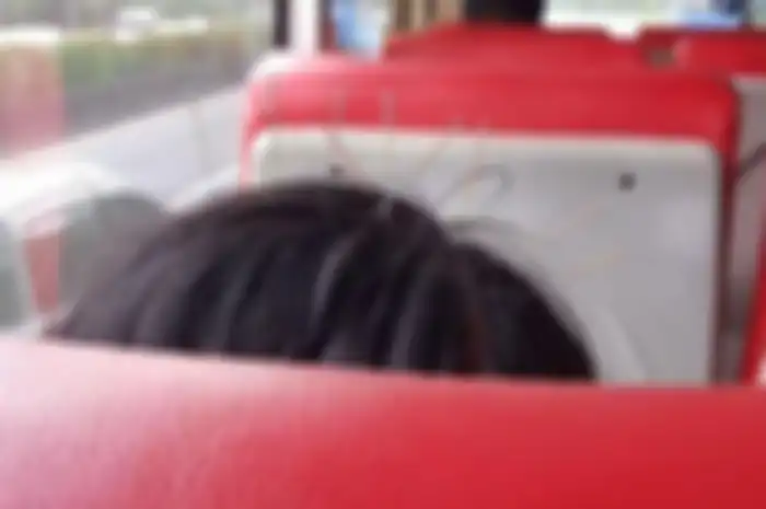 Foto Kepala Wanita Ditusuk Sembilan Jarum Saat Naik Bus Viral di Facebook  