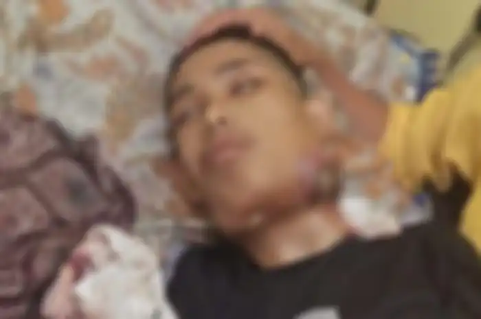 Kondisi Asep Rahayu (22) terbaring lemah dan tidak berdaya  