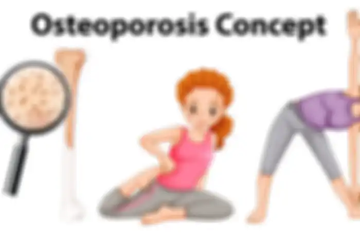 Wanita lebih berisiko terkena osteoporosis atau pengeroposan tulang dibandingkan pria.