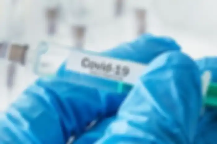 Diharapkan pemberian vaksin Covid-19 akan mengurangi angka penyebaran virus dan infeksi penyakit akibat virus corona.