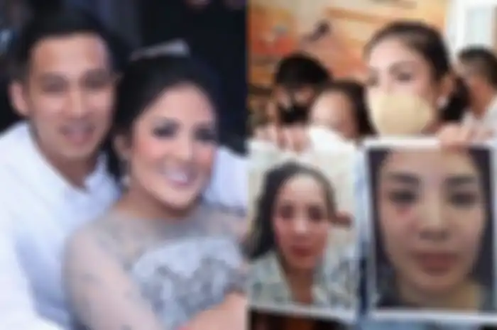 Nindy Ayunda bongkar borok Askara Parasady Harsono 