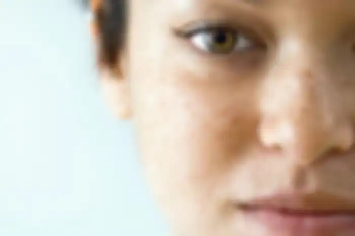 5 Cara Menghilangkan Flek Hitam di Wajah Dengan Mengunakan Bahan Alami