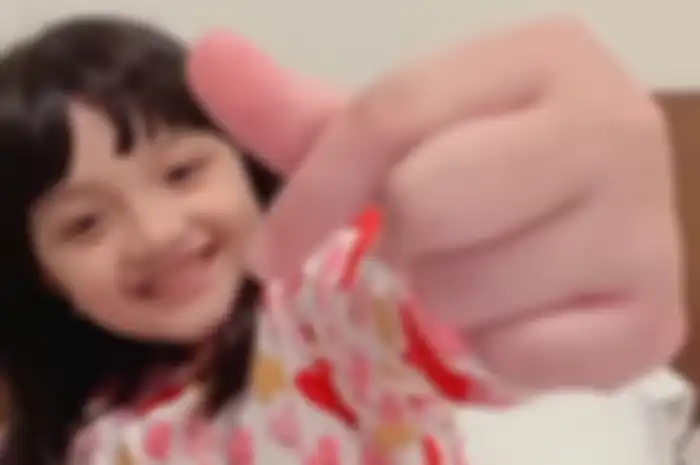 Kondisi Arsy