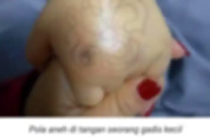Gambar aneh ditemukan di tangan seorang gadis kecil.
