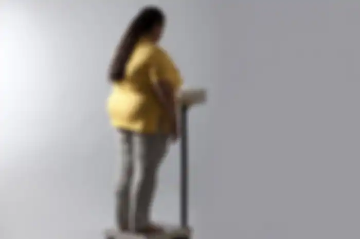 Ilustrasi obesitas