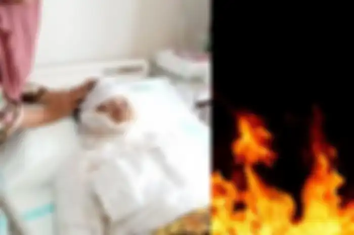 Suami di Deli Serdang bakar istri, nyawa korban tak tertolong