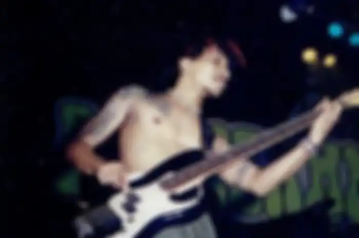 Kondisi Hubert Henry, Bassist Boomerang Kritis Usai Pecah Pembuluh Darah di Syaraf Otaknya