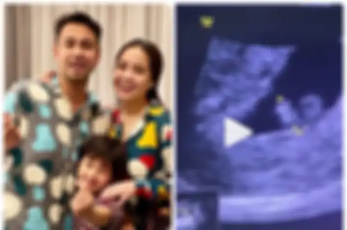 Nagita Slavina hamil anak kedua
