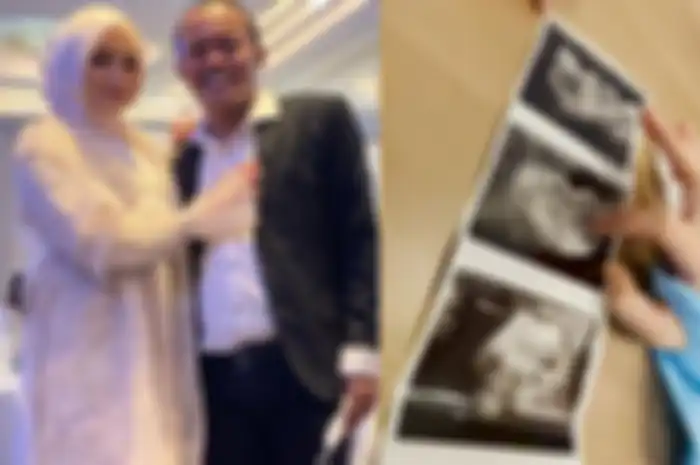 Diisukan Pisah Ranjang Hingga Nyaris Bercerai, Nathalie Hoslcher Tiba-tiba Kejutkan Publik Saat Umumkan Positif Hamil, Netizen Seketika Heboh Minta Sule Lakukan Ini