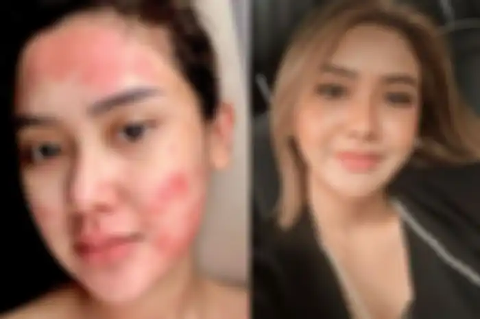 Pedangdut Cita Citata