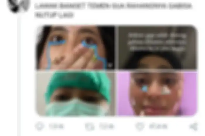 seorang perempuan viral lantaran tak bisa menutup rahangnya usai menguap