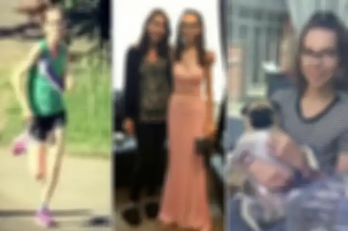 Lisa Fouweather (19) gadis asal Doncaster, South Yorkshire, Inggris, yang tubuhnya menjadi kurus kering dan hampir meninggal akibat terlalu banyak berolahraga. 
