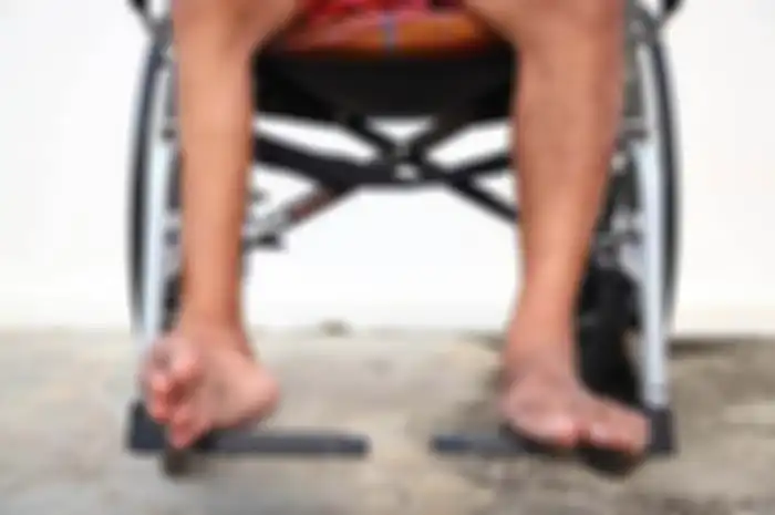 Ilustrasi kaki lumpuh