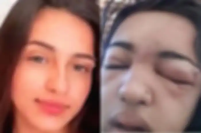 Izabela Eduarda de Sousa, gadis 15 tahun yang meninggal dunia setelan menindik sendiri alisnya