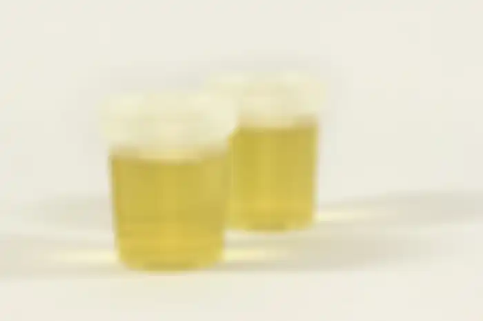 Urine berubah warna karena makanan dan minuman yang dikonsumsi.