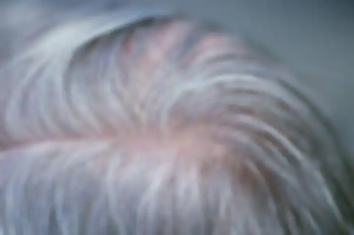 Rambut beruban