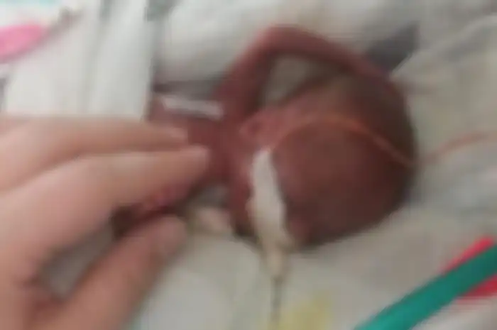 Richard Scott William Hutchinson, bayi paling prematur di dunia