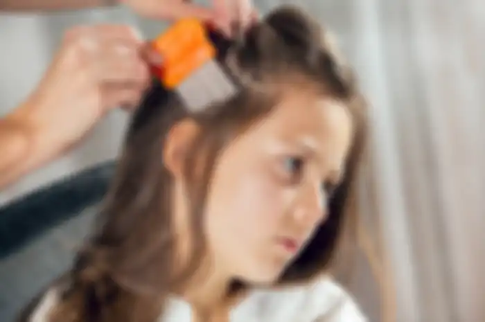 Mengatasi kutu rambut dengan sisir serit.
