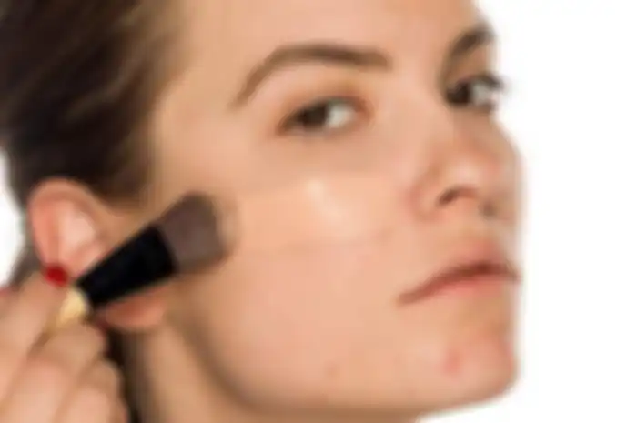 Ilustrasi wajah jerawatan setelah pakai makeup