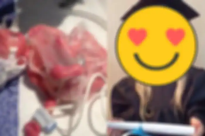 Potret Darcey Clegg saat baru lahit dan sudah lulus Taman Kanak-kanak 