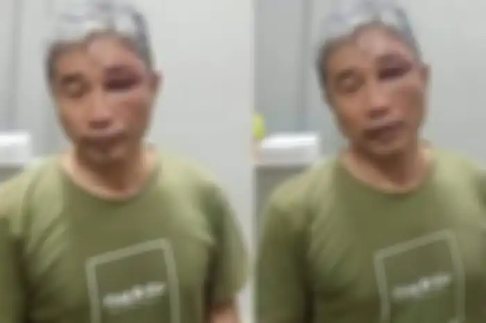 Disebut lumuri Muhammad Kece dengan tinja, Jenderal Napoleon Bonaparte buka suara. Foto tampang bengap sang YouTuber menjadi bukti.
