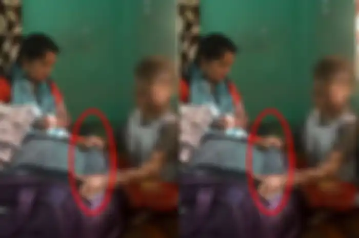 Bocah 16 tahun ini terlahir dnegan kulit mirip ular