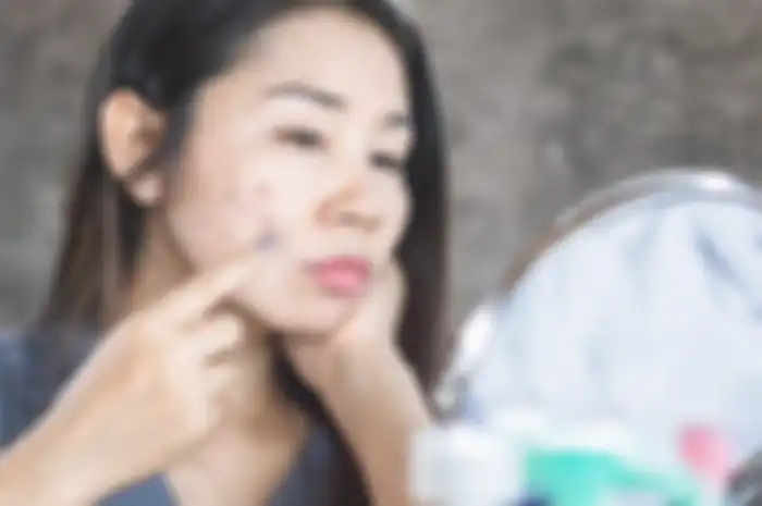 menghilangkan flek hitam
