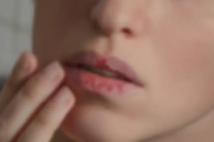 DIY scrub untuk mengatasi bibir pecah-pecah