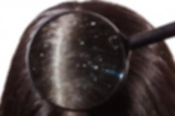 Illustrasi Rambut Berketombe