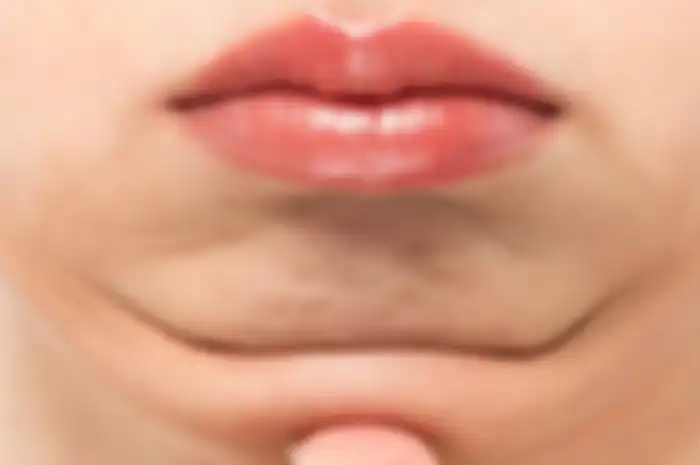 Ilustrasi double chin