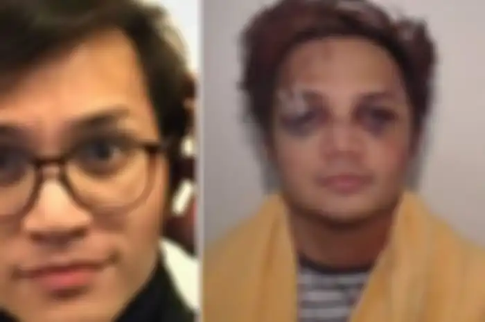 Reynhard Sinaga - Kepolisian Manchester Raya merilis foto Reynhard saat ditangkap dalam kondisi babak belur tahun 2017