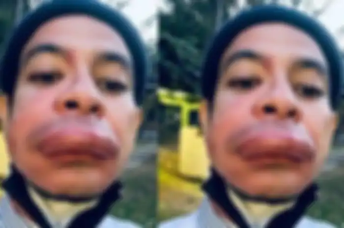 Aktor ini ceritakan pengalaman tidak menyenangkan saat bibir jontor usai cuci muka pagi-pagi.