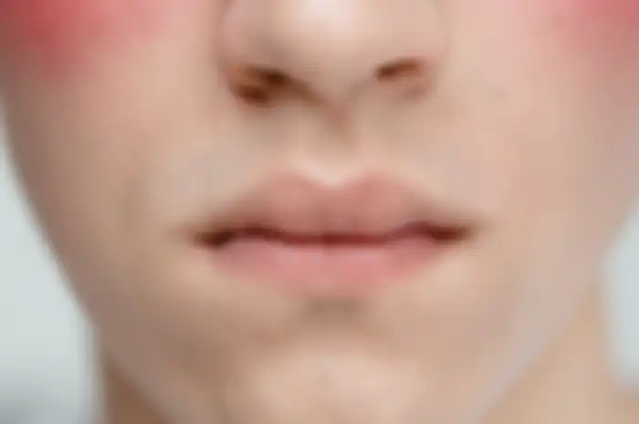 Mencerahkan bibir gelap