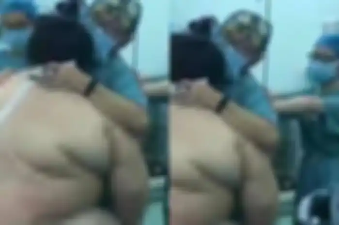 16 tenaga medis bantu persalinan ibu dengan berat badan 127 kg