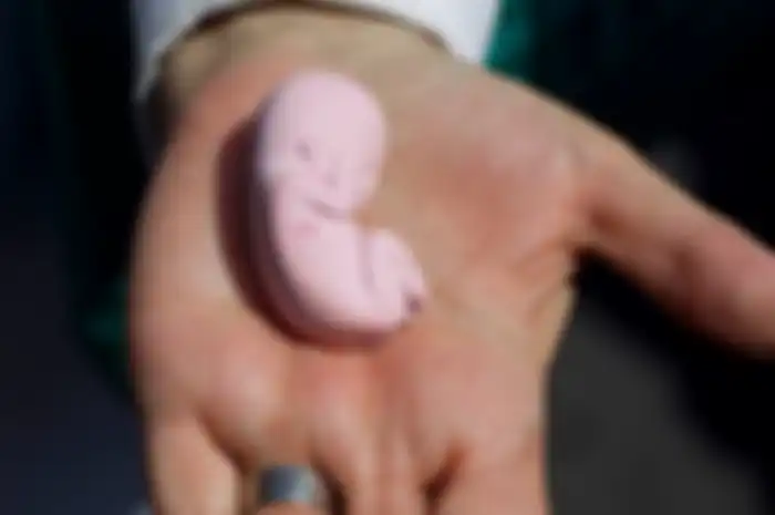 Ilustrasi aborsi 