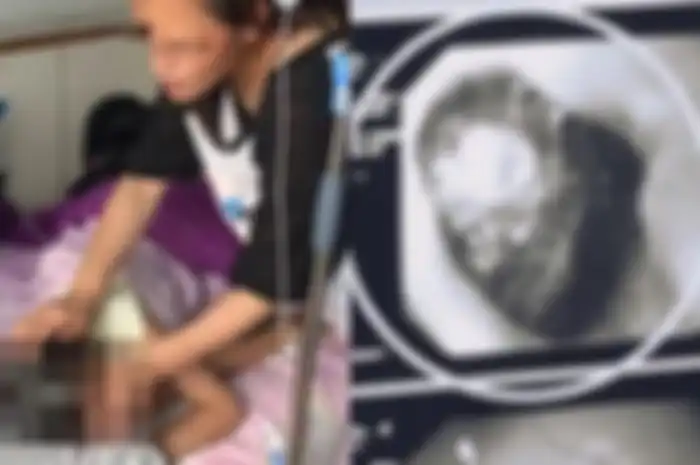 Ibu ini syok dapati hal mengerikan di dalam perut putrinya