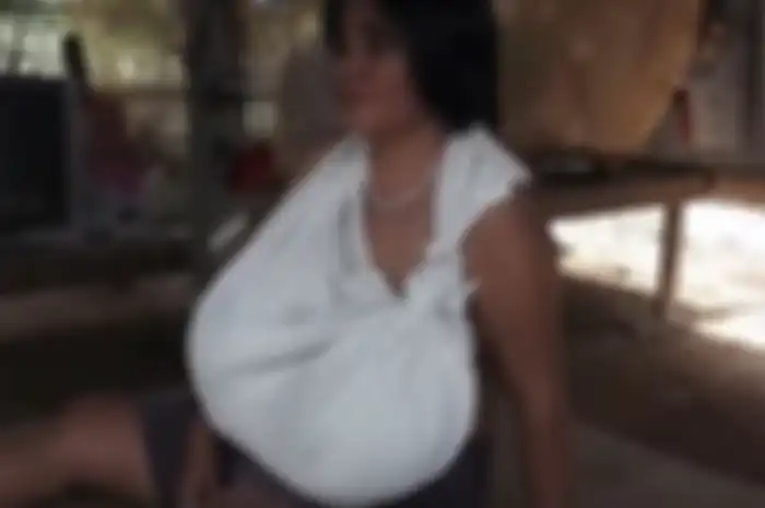 Lam Phrai Si Nuan asal Thailand, mengalami kondisi aneh lantaran payudaranya terus membesar. 