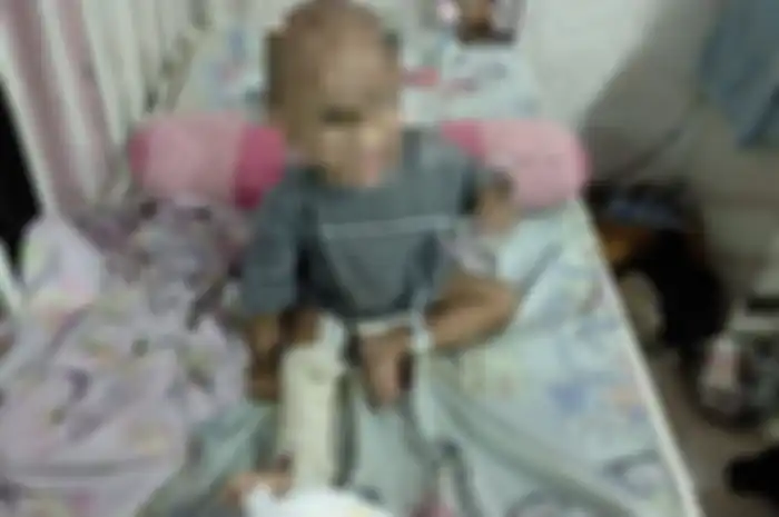 Kondisi balita MD (3) usai diselamatkan orang tua angkatnya dari rumah sang ibu kandung.
