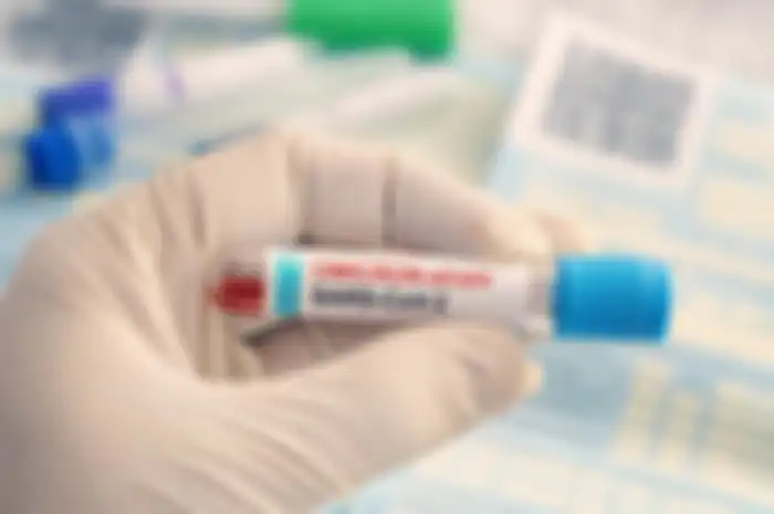 Covid-19 varian Omicron telah menyebar ke sejumlah negara di Afrika, Eropa, Australia, dan Asia.