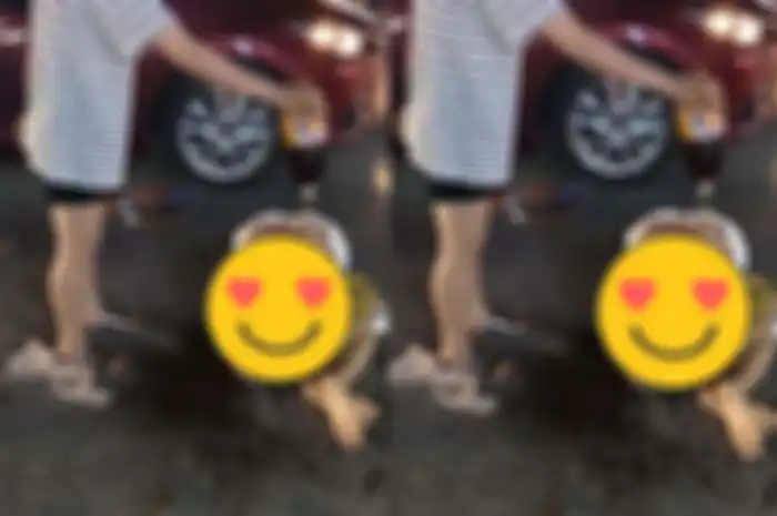 Wanita ini alami luka bakar usai diguyur sambal 