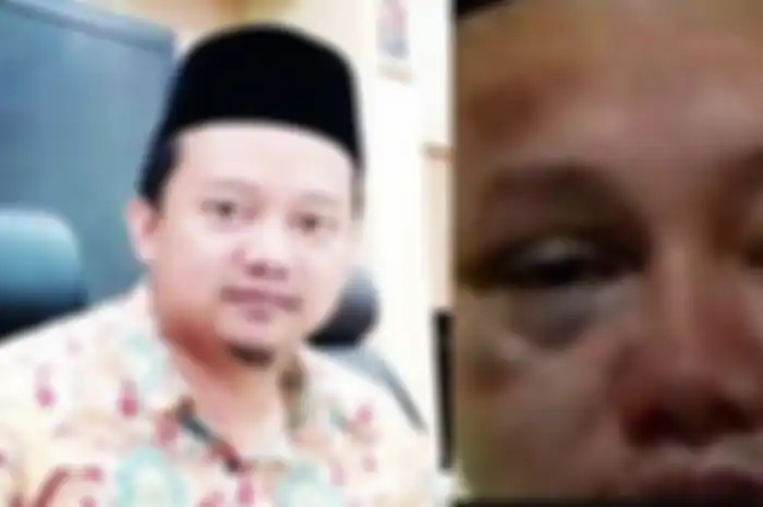 Potret Herry Wirawan babak belur viral di media sosial